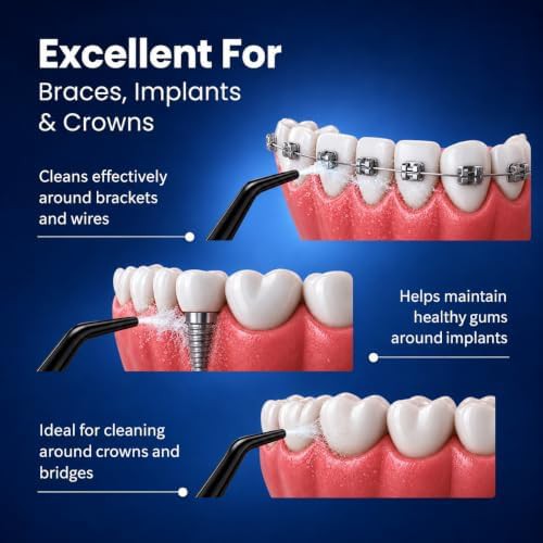Black cordless oral irrigator with four modes — photo 4