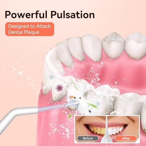Pink rechargeable oral irrigator 300ml — photo 3