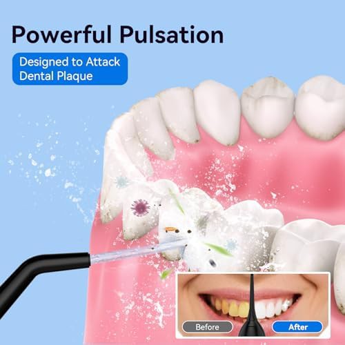 Black cordless portable water flosser 300ml — photo 3