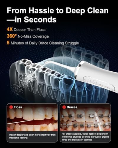 MySmile LP211 cordless water flosser 260ml — photo 3