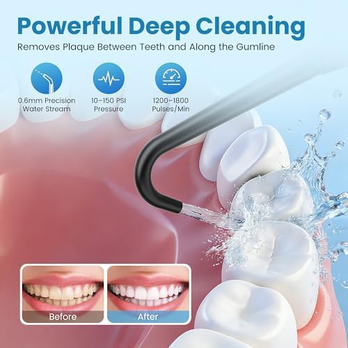Cordless water flosser with 300ml tank and five tips — photo 3
